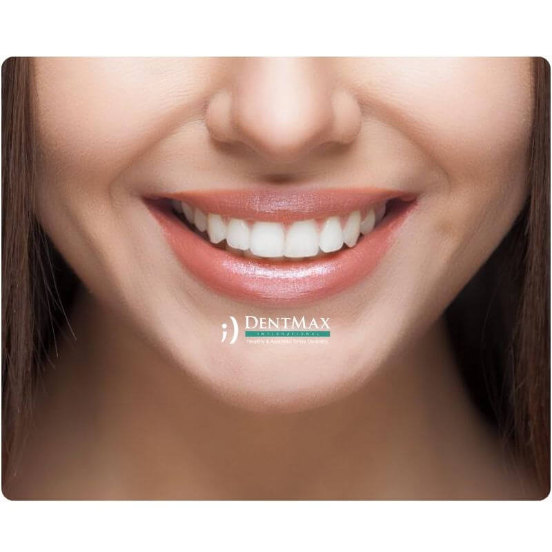 Dentmax