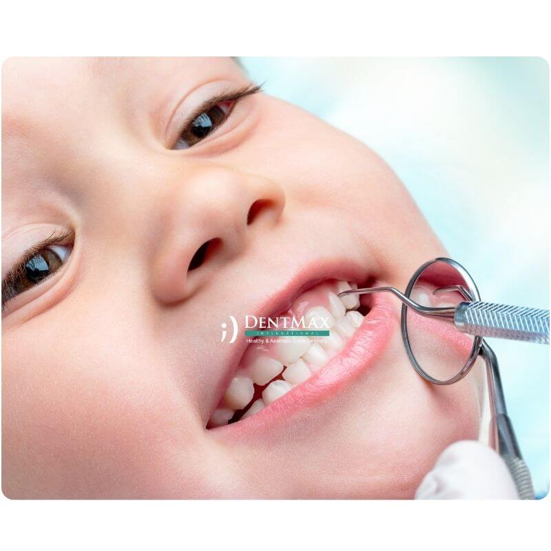 Dentmax