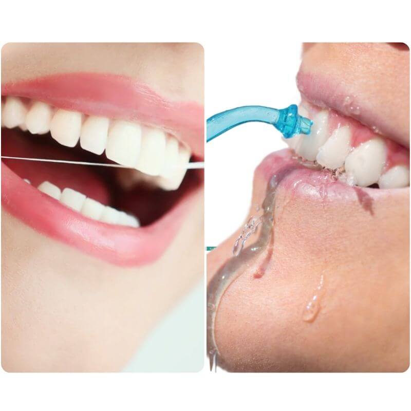 Dentmax