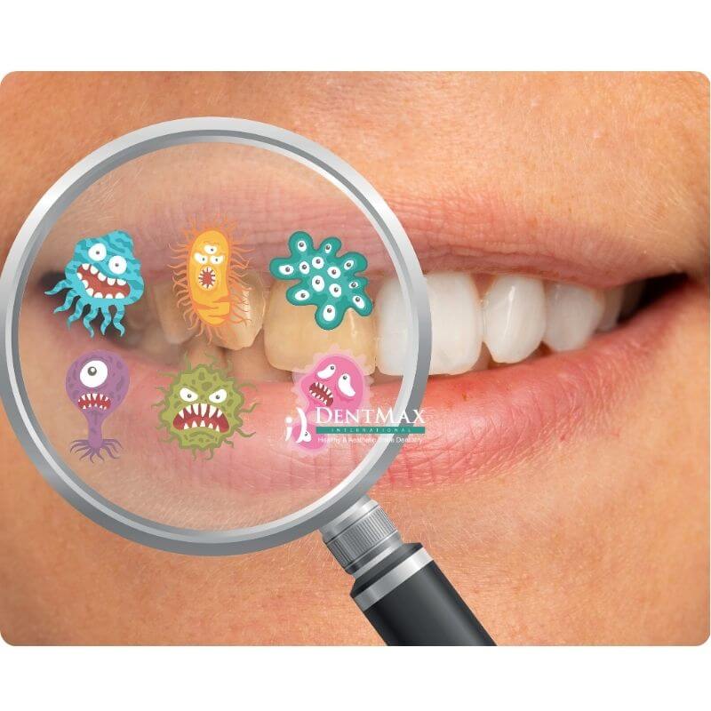 Dentmax