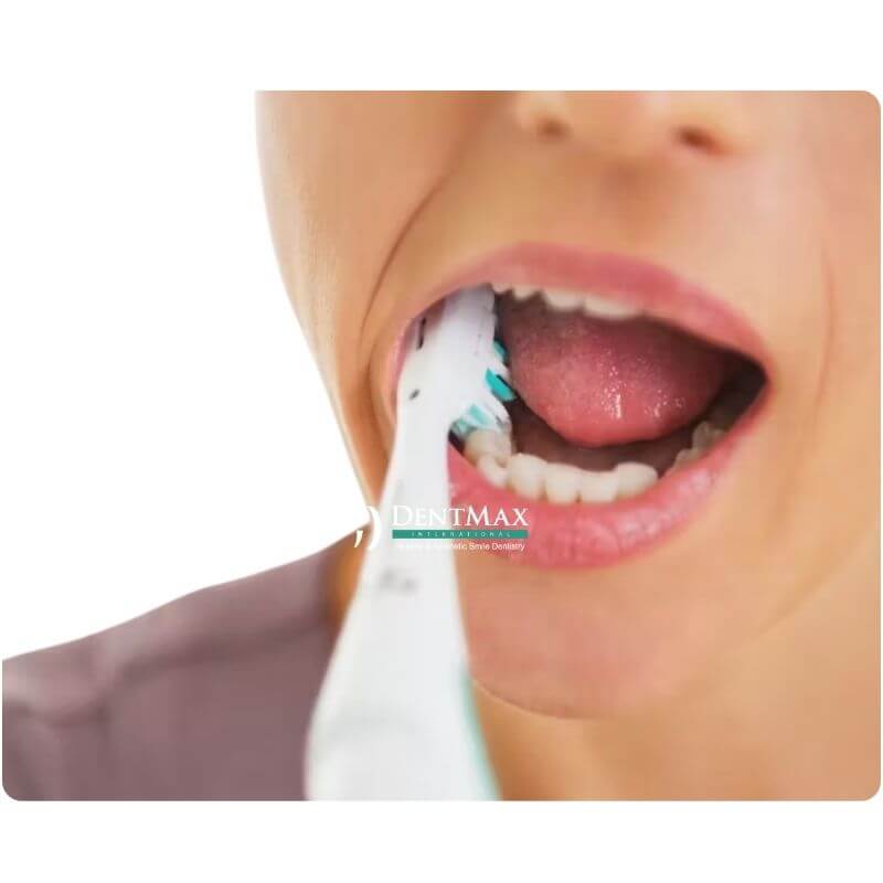 Dentmax