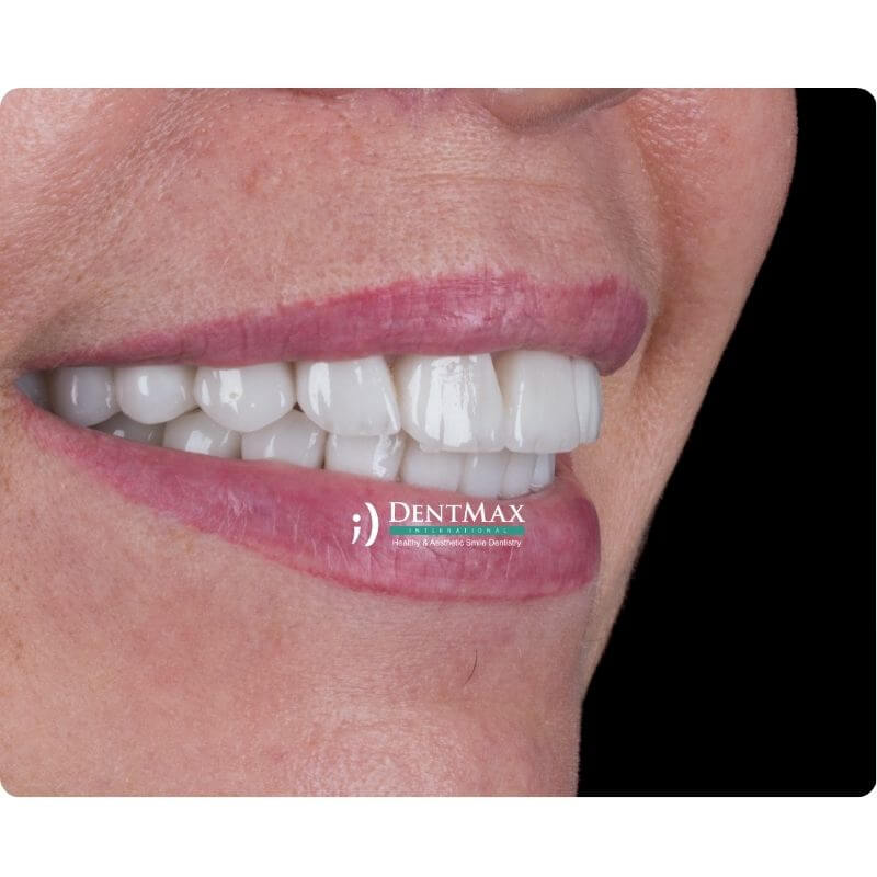 Dentmax Öne Çıkanlar