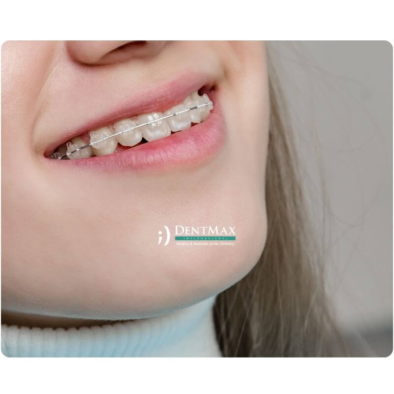 Dentmax