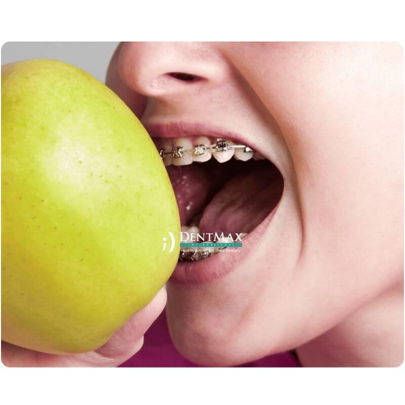 Dentmax