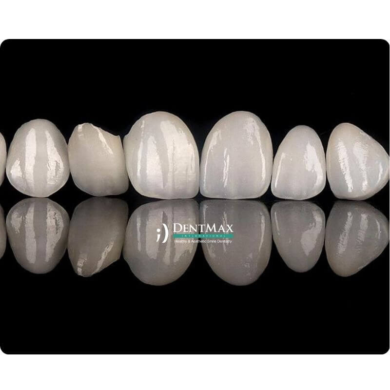 Dentmax