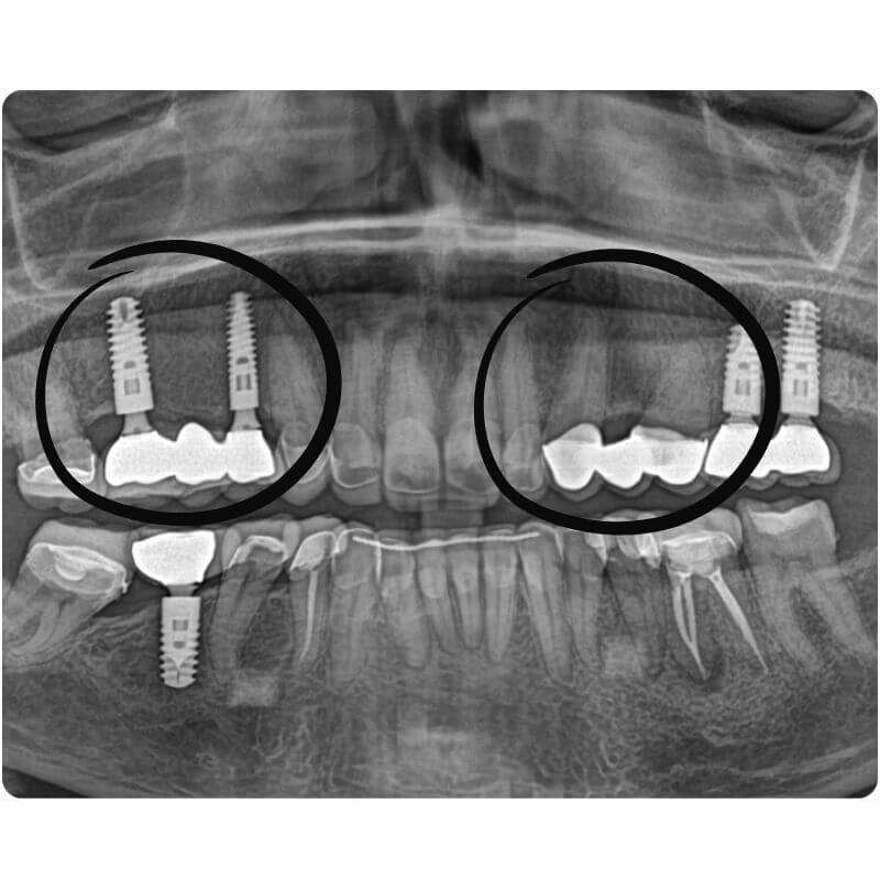 Dentmax