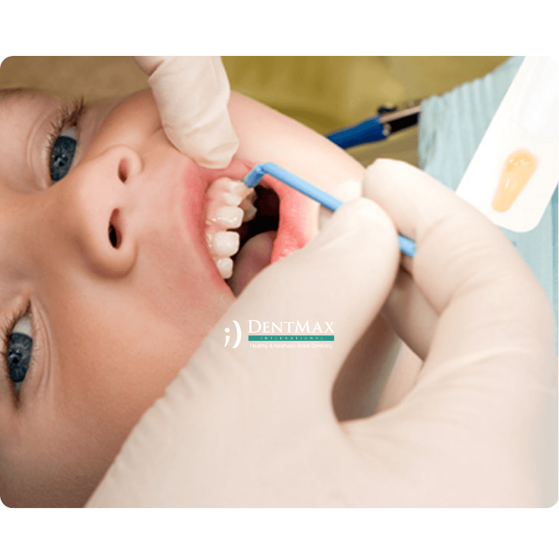 Dentmax