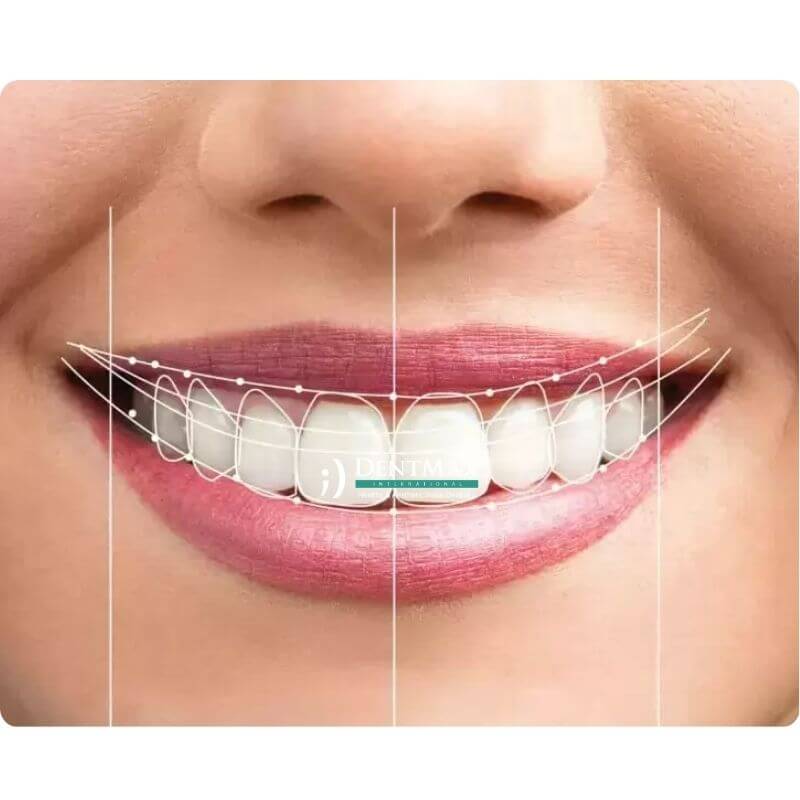 Dentmax