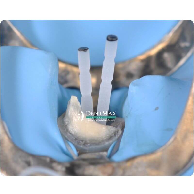Dentmax