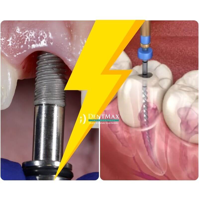 Dentmax