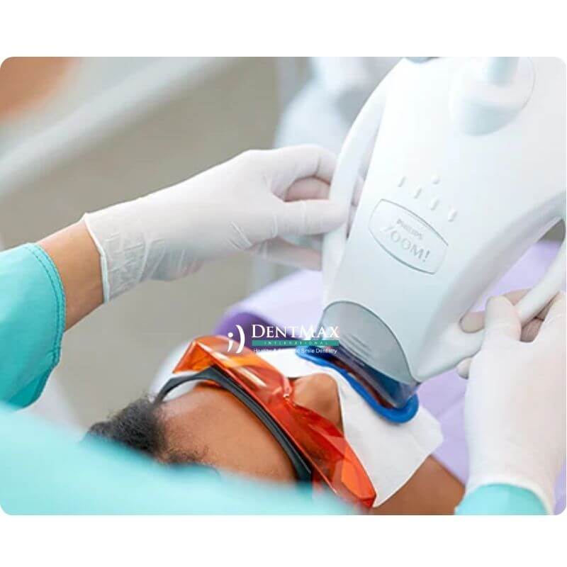 Dentmax