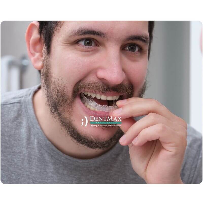 Dentmax