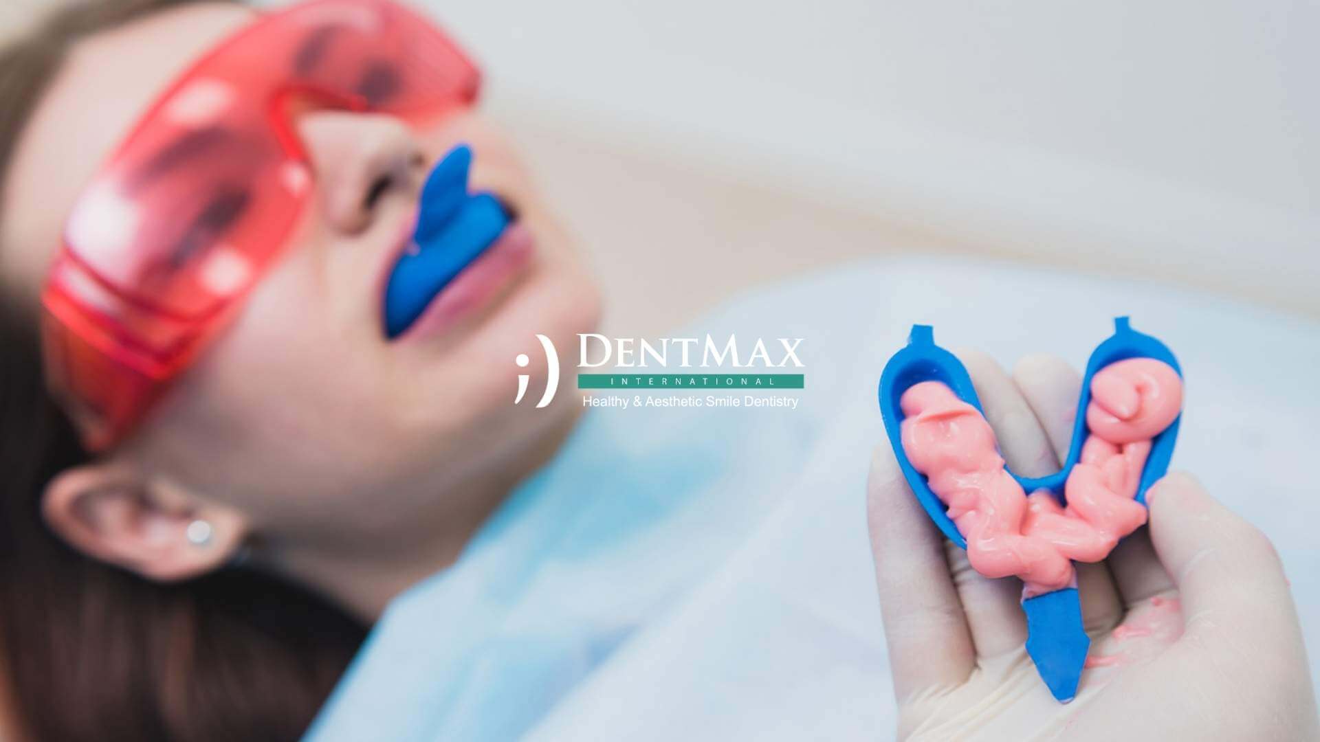 Dentmax Tedaviler