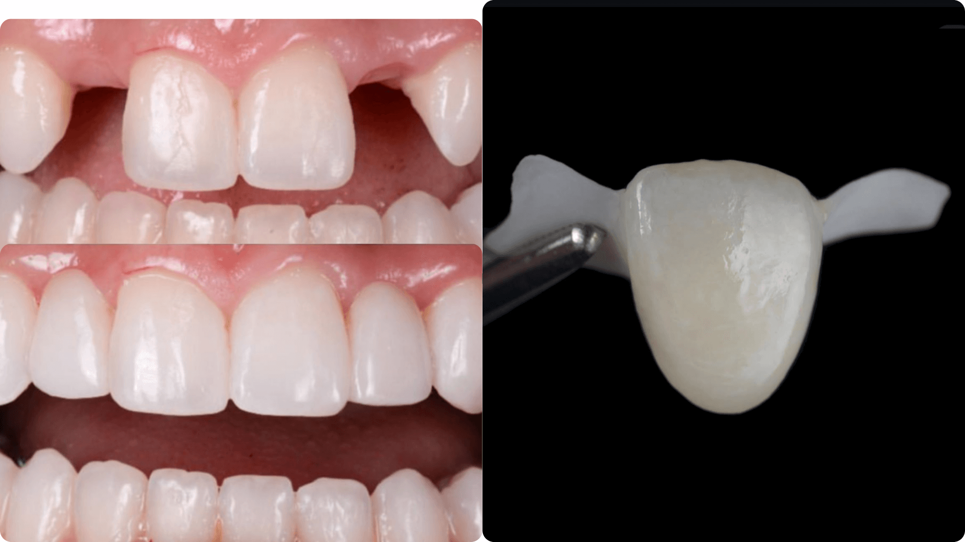Dentmax Tedaviler