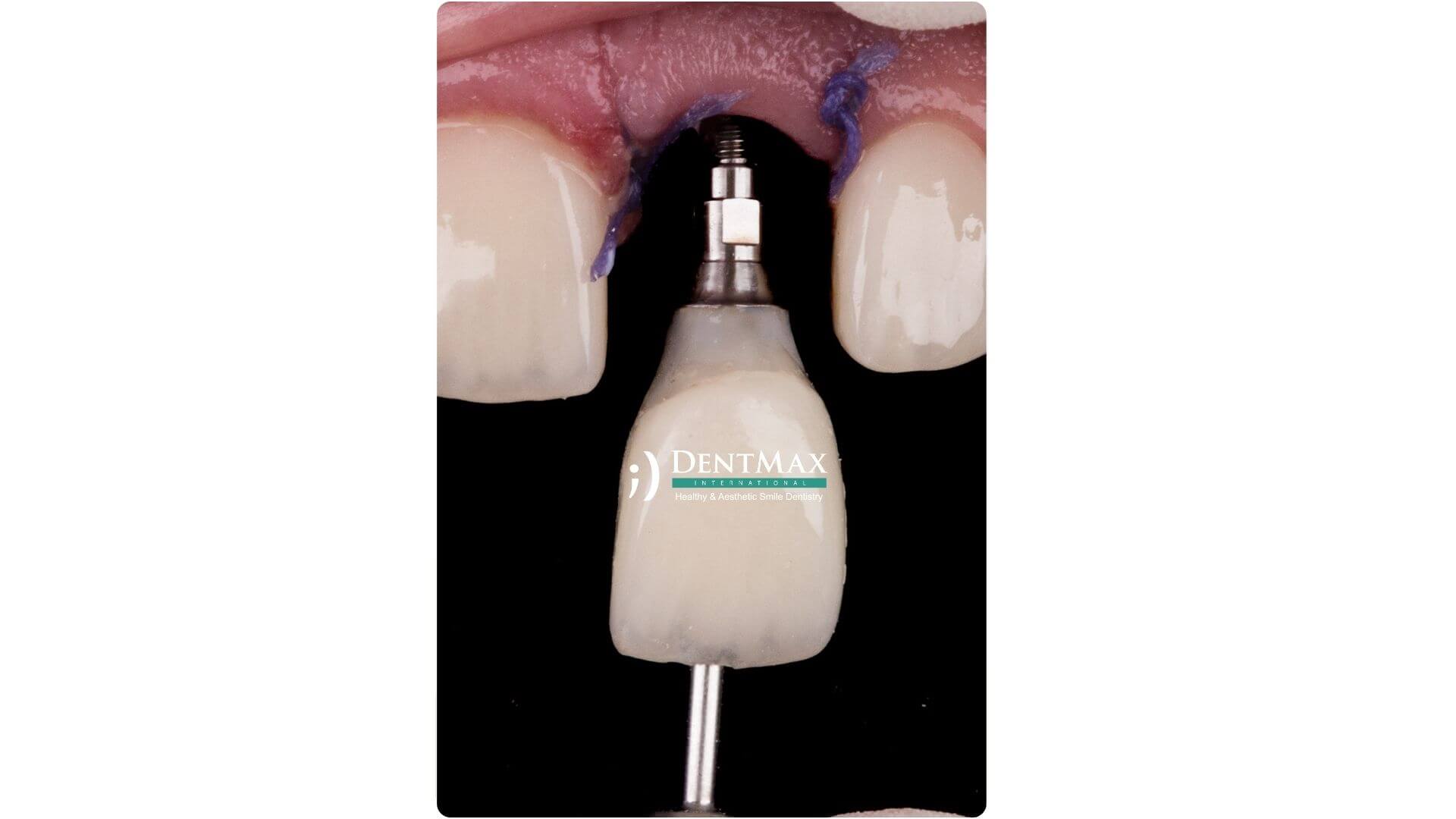Dentmax Banner