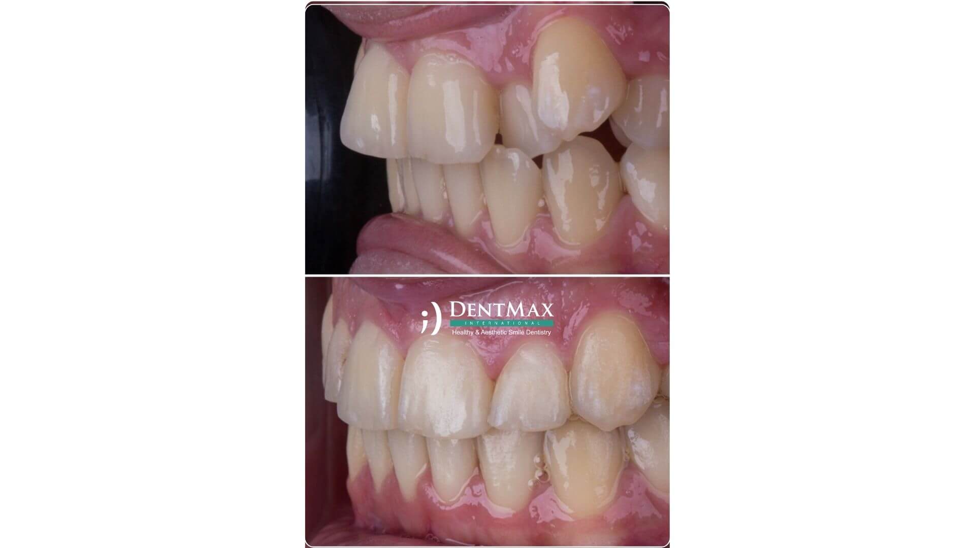 Dentmax Banner