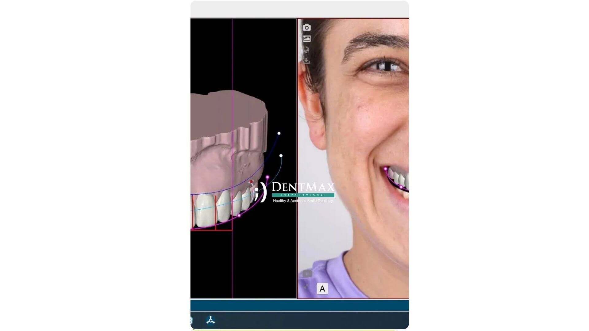 Dentmax Banner