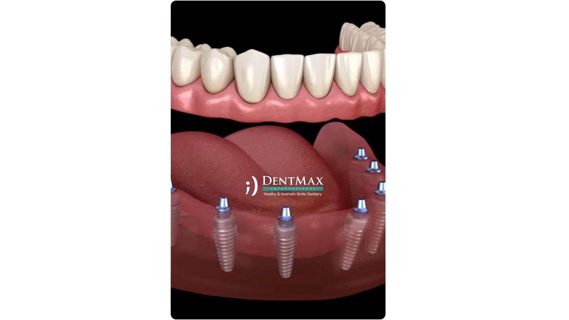 Dentmax Banner