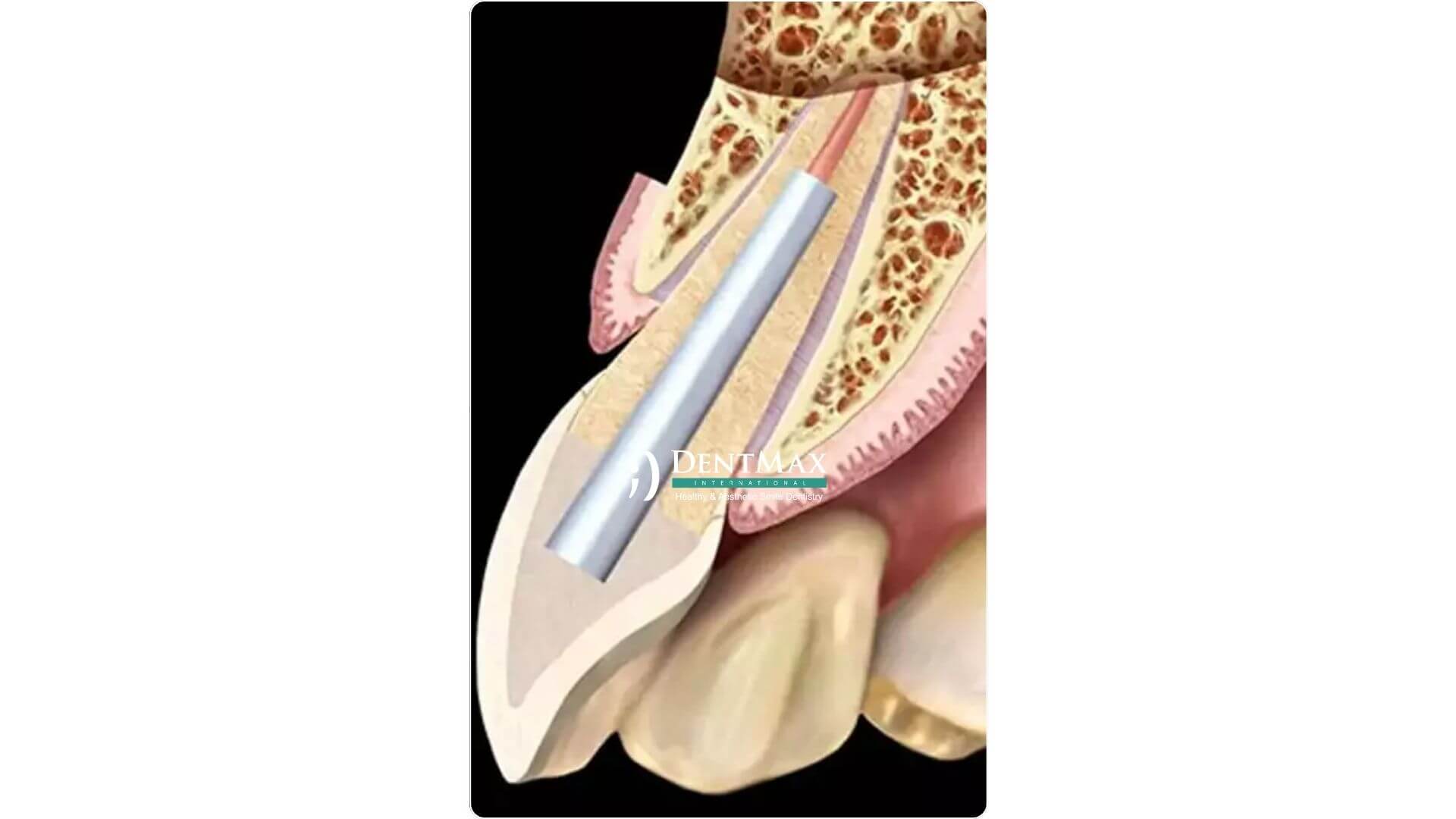 Dentmax Banner