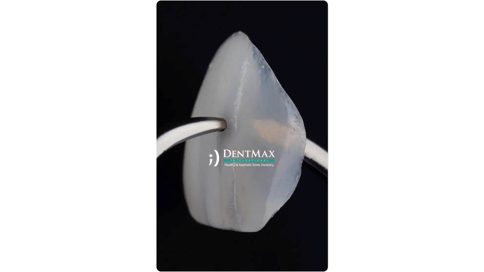 Dentmax Banner