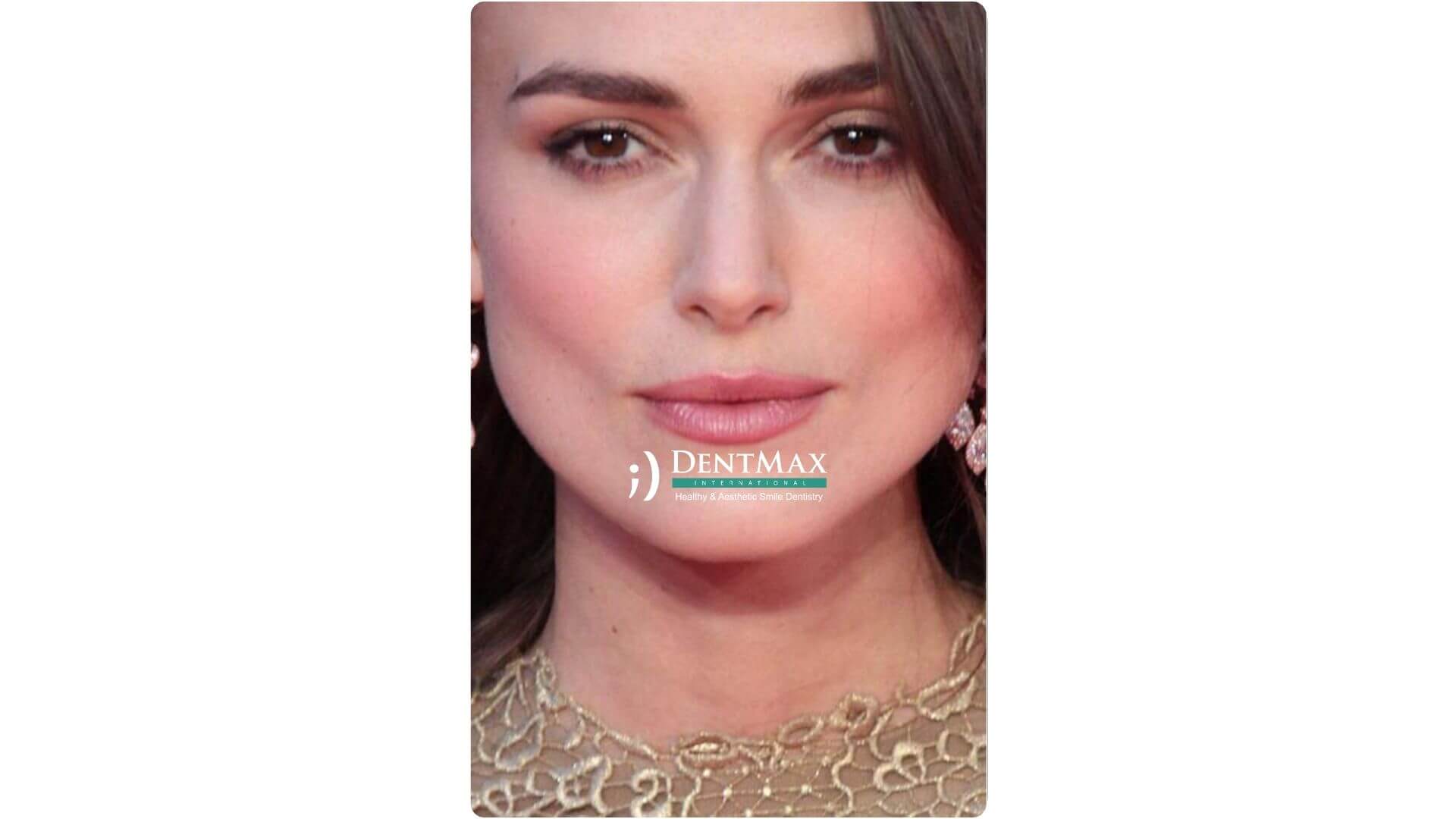Dentmax Banner