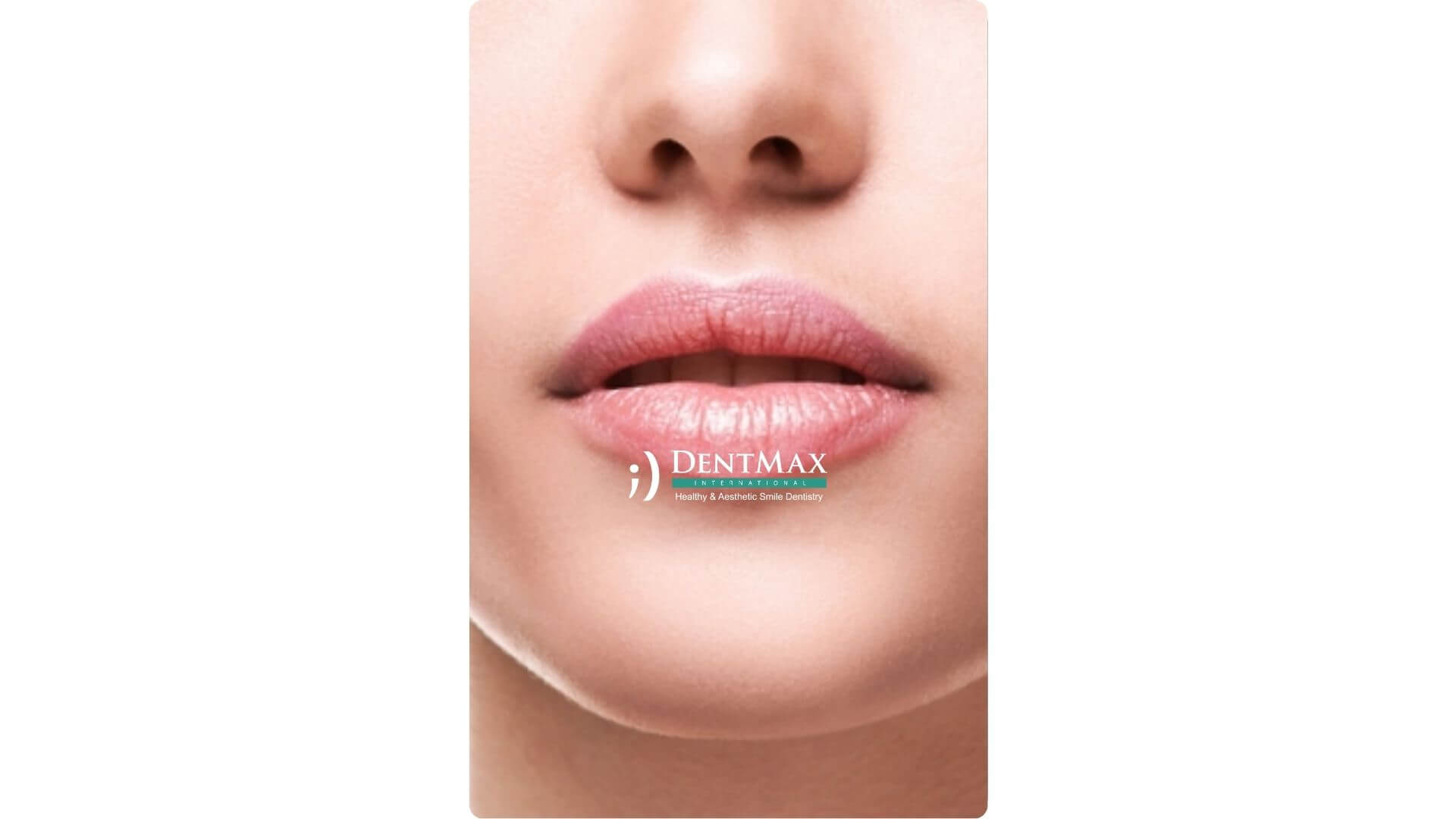 Dentmax Banner