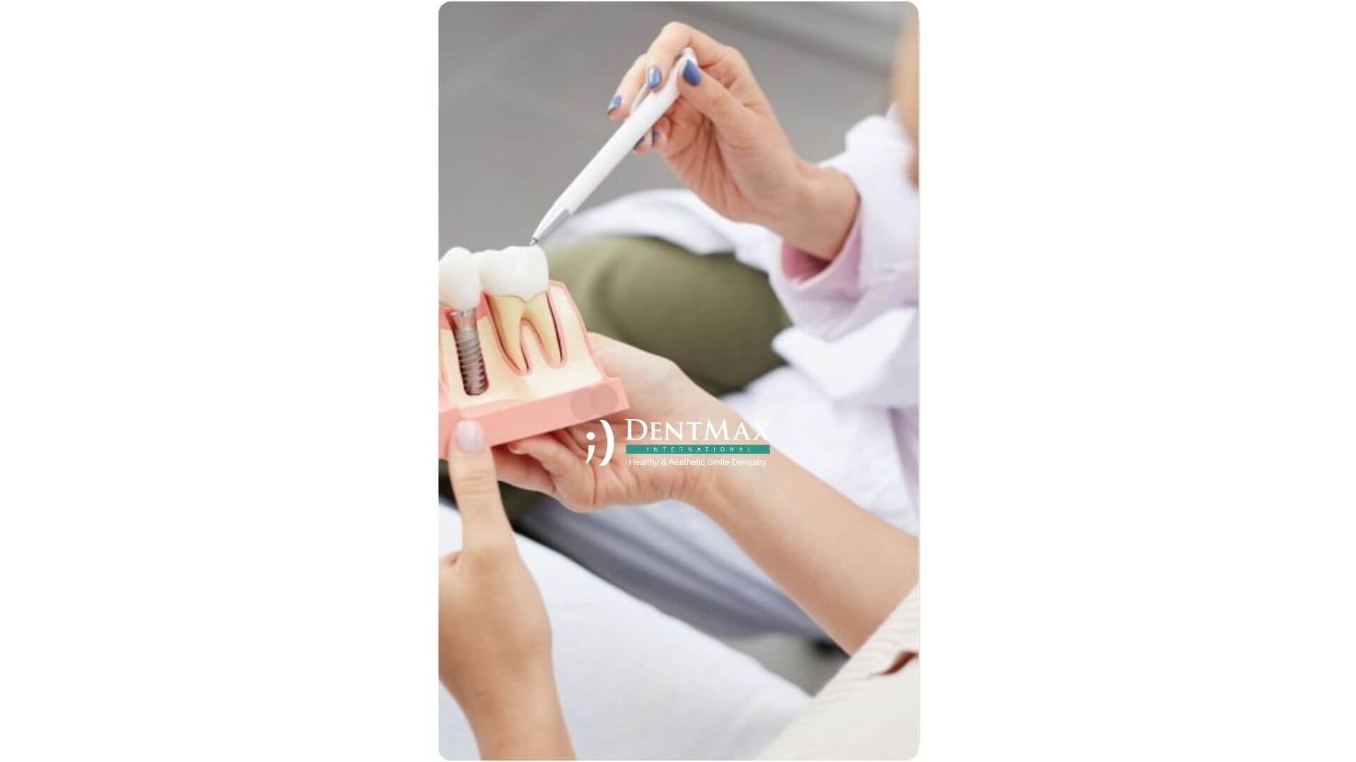 Dentmax Banner