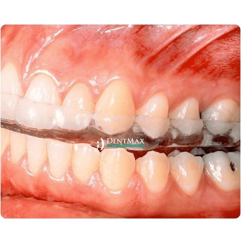 Dentmax Banner