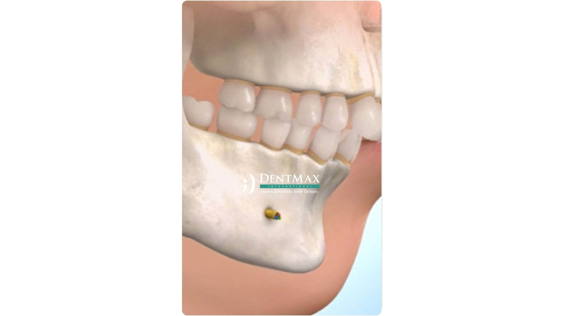 Dentmax Banner