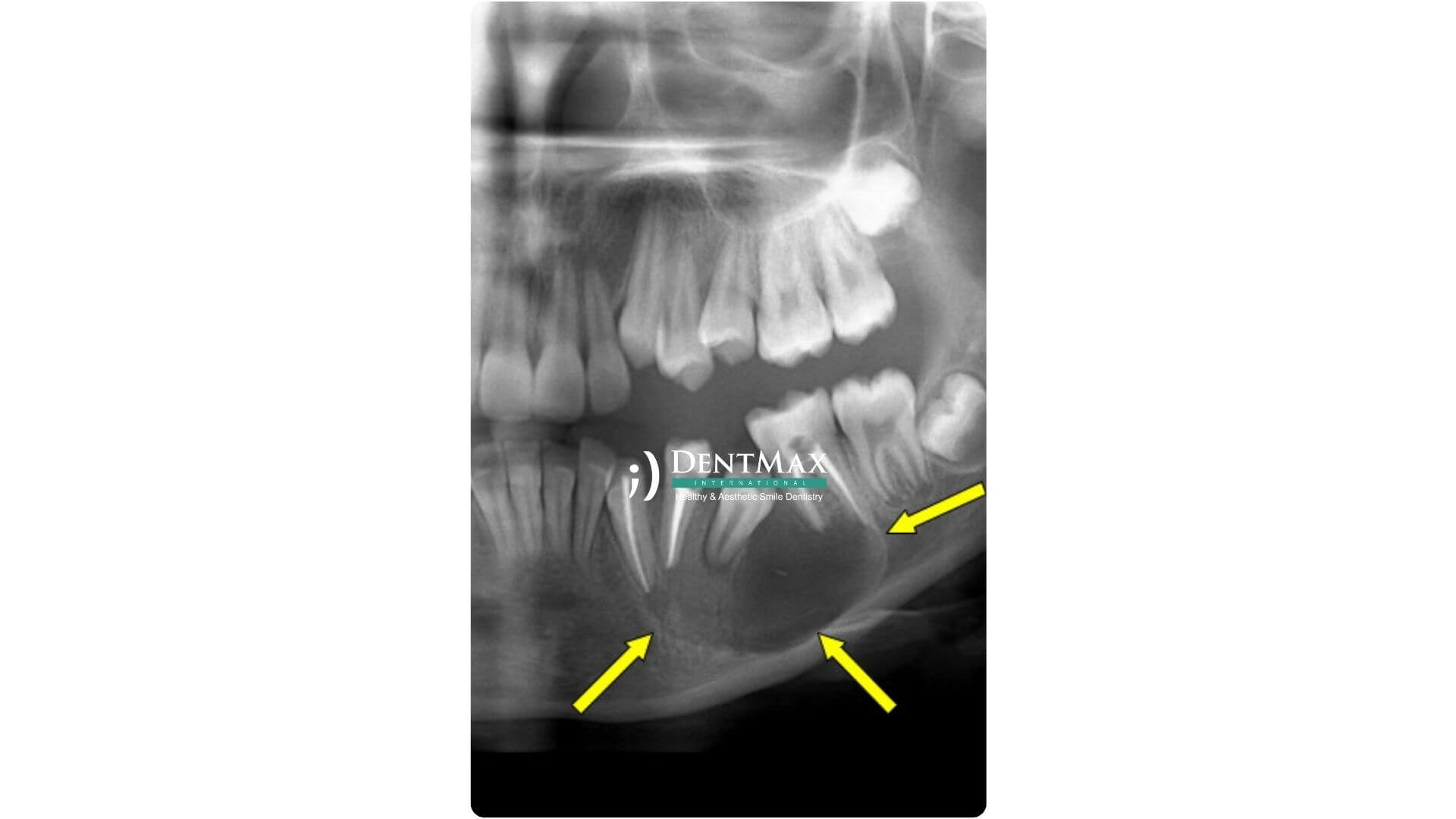 Dentmax Banner