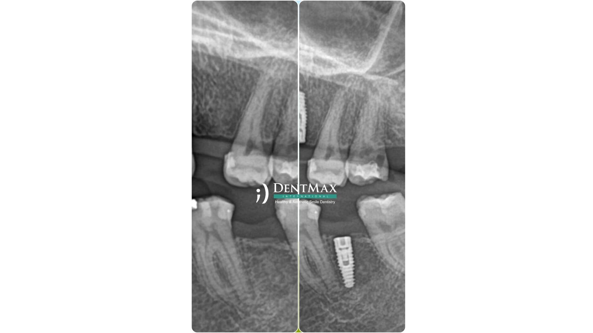 Dentmax Banner