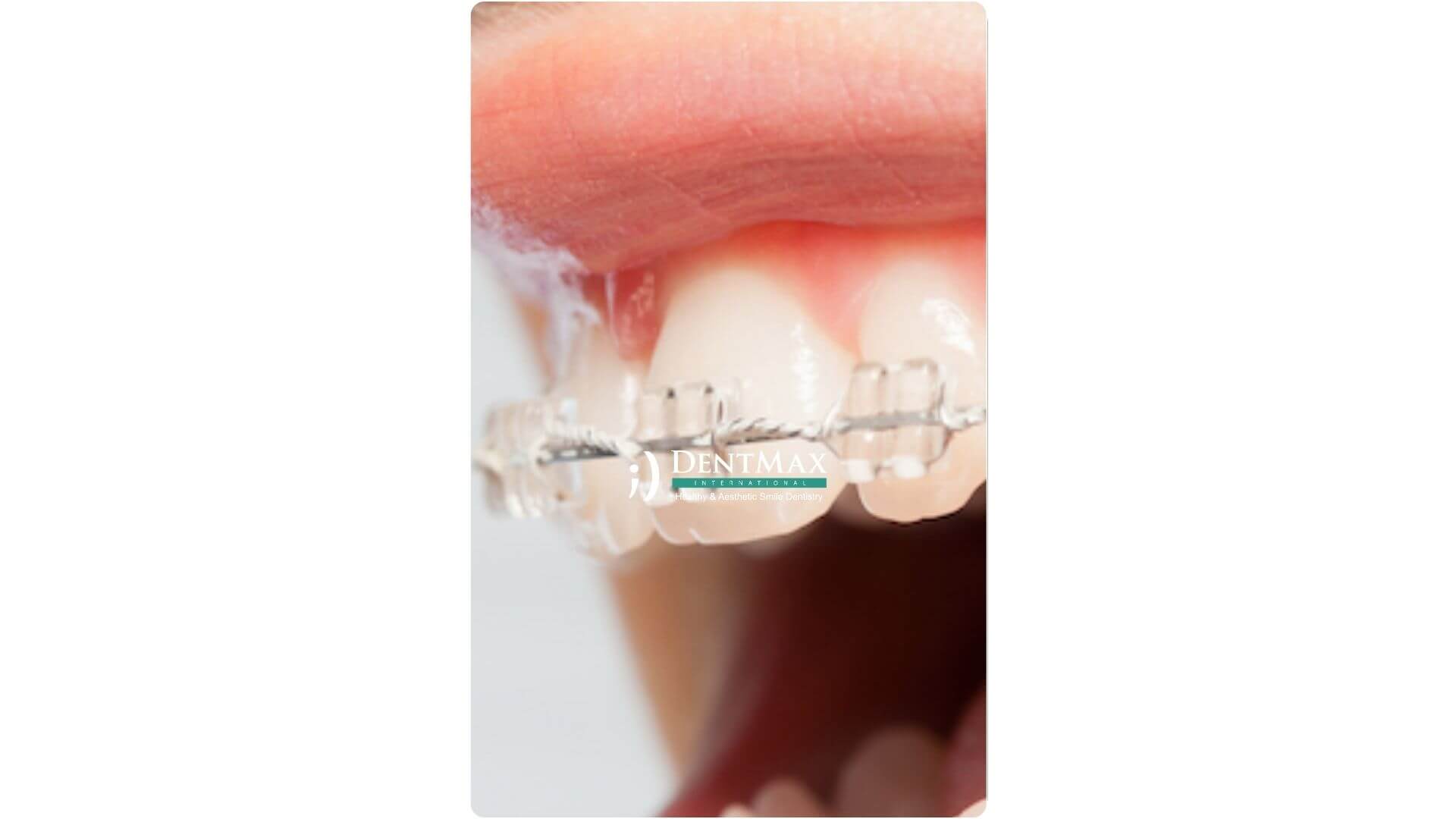 Dentmax Banner