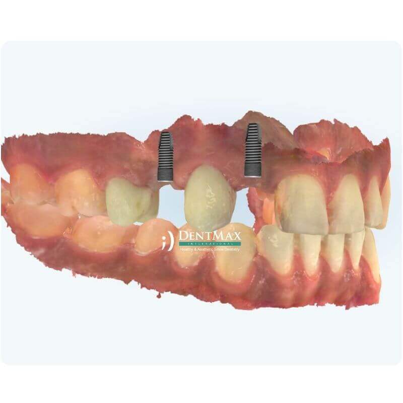 Dentmax Banner