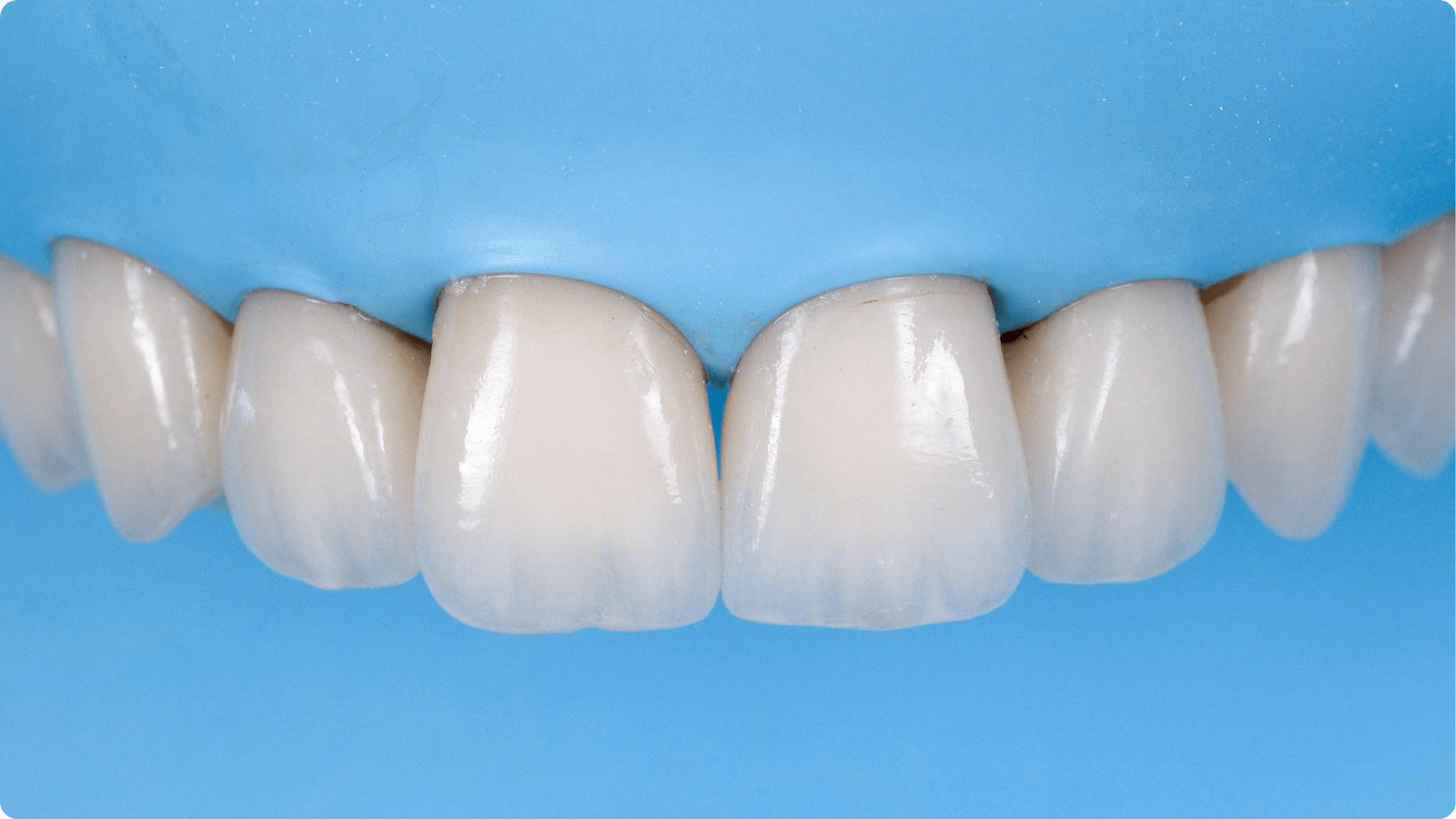 Dentmax Banner