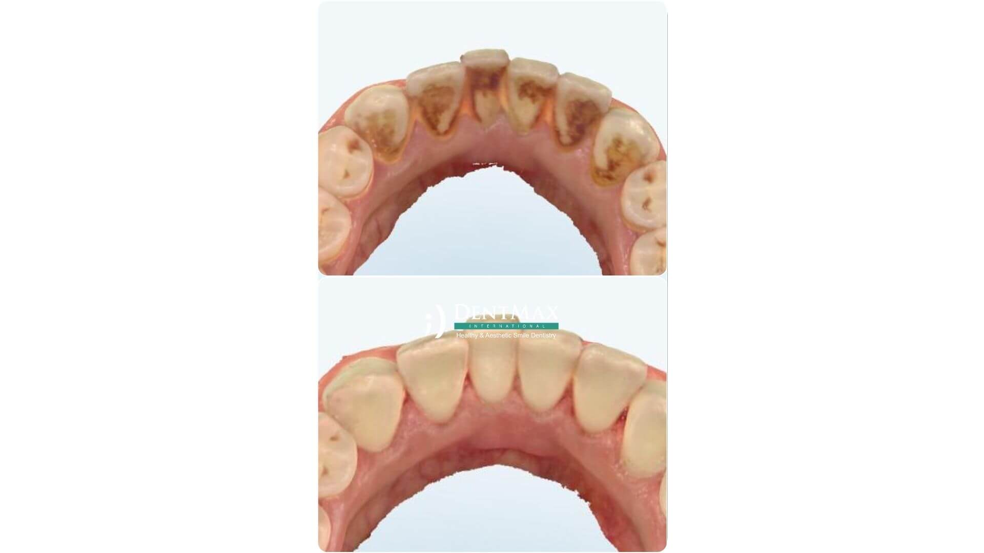 Dentmax Banner