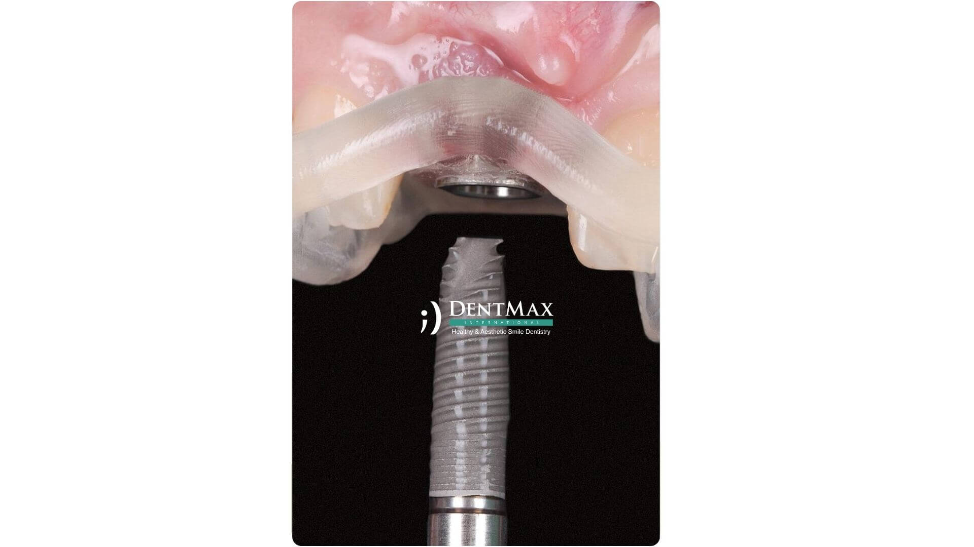 Dentmax Banner