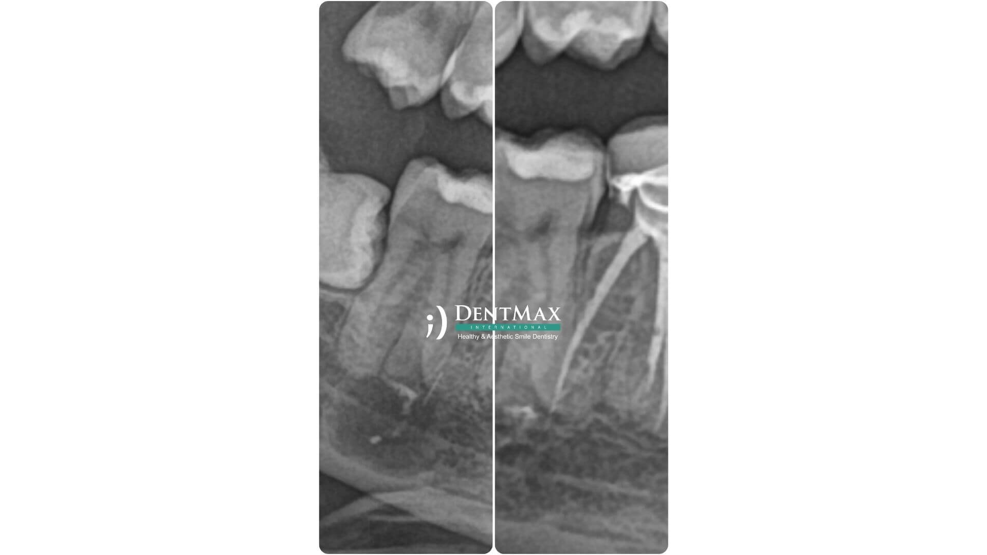 Dentmax Banner