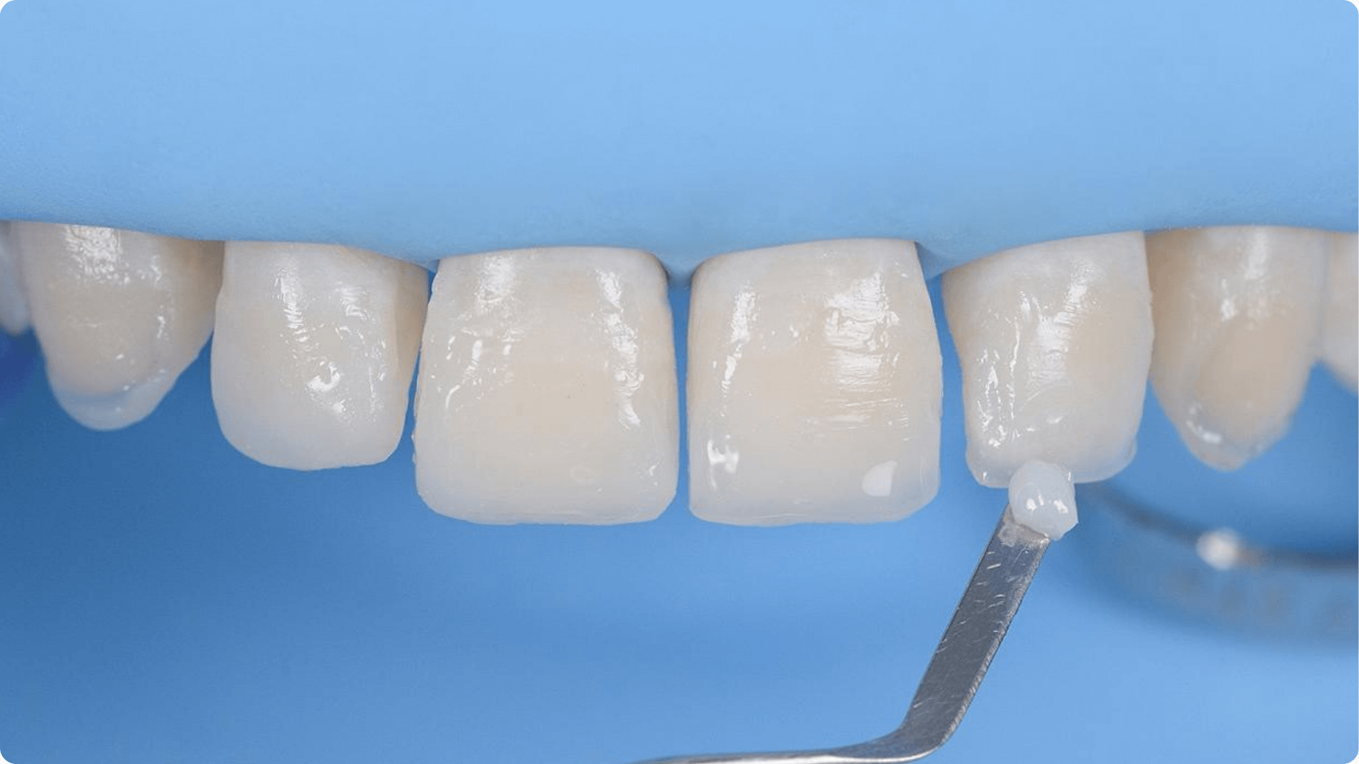 Dentmax Banner