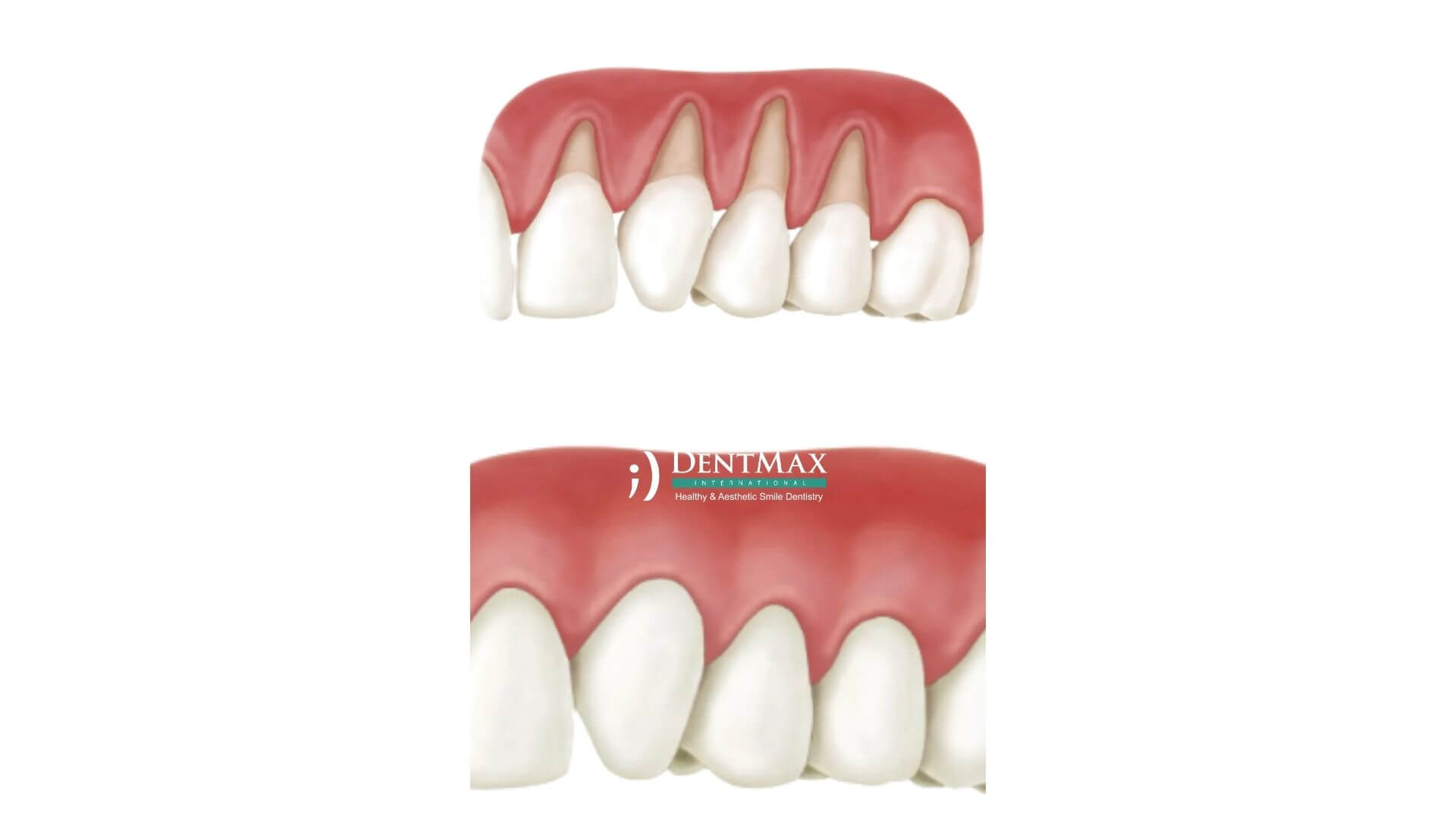 Dentmax Banner