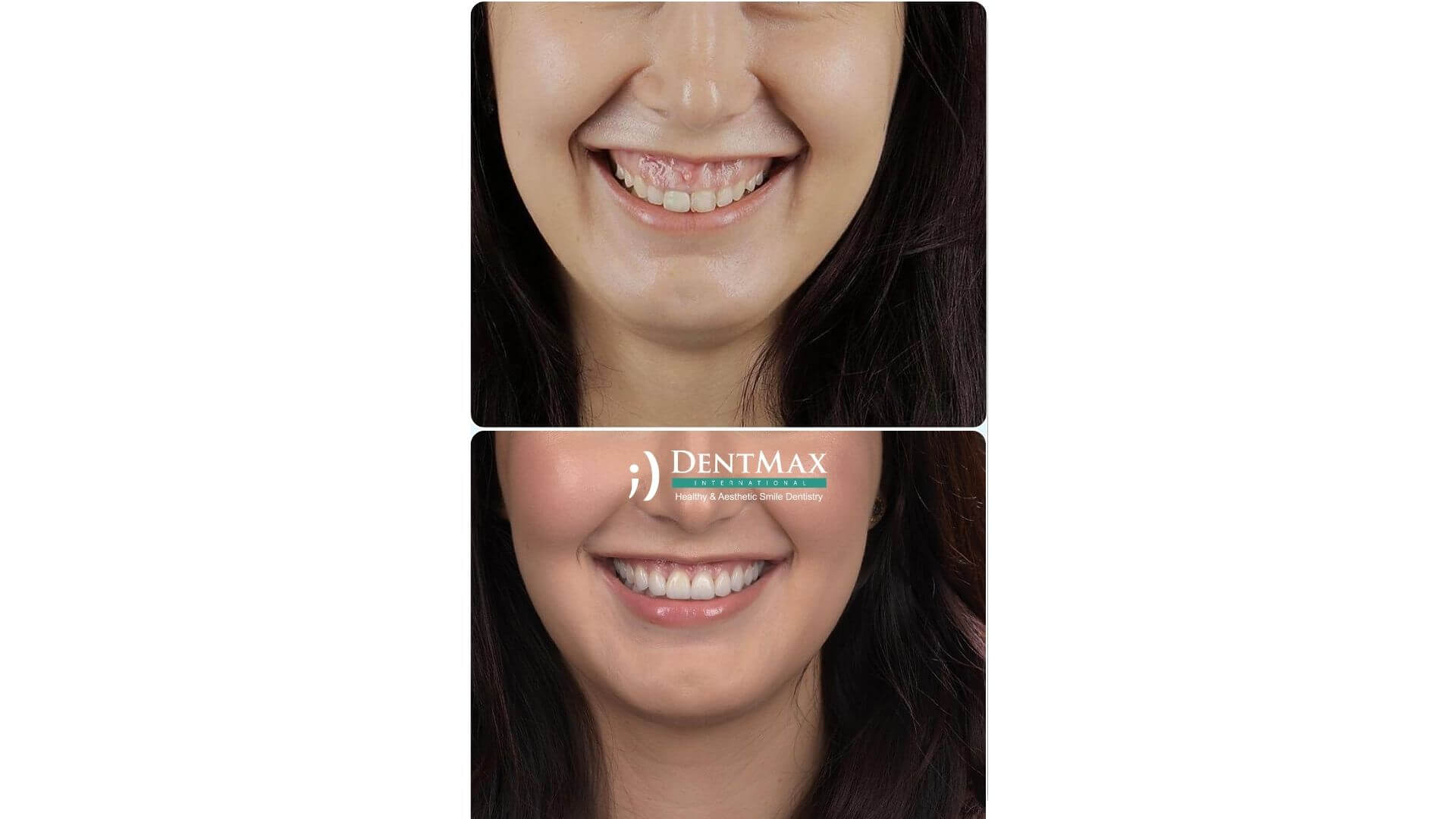 Dentmax Banner