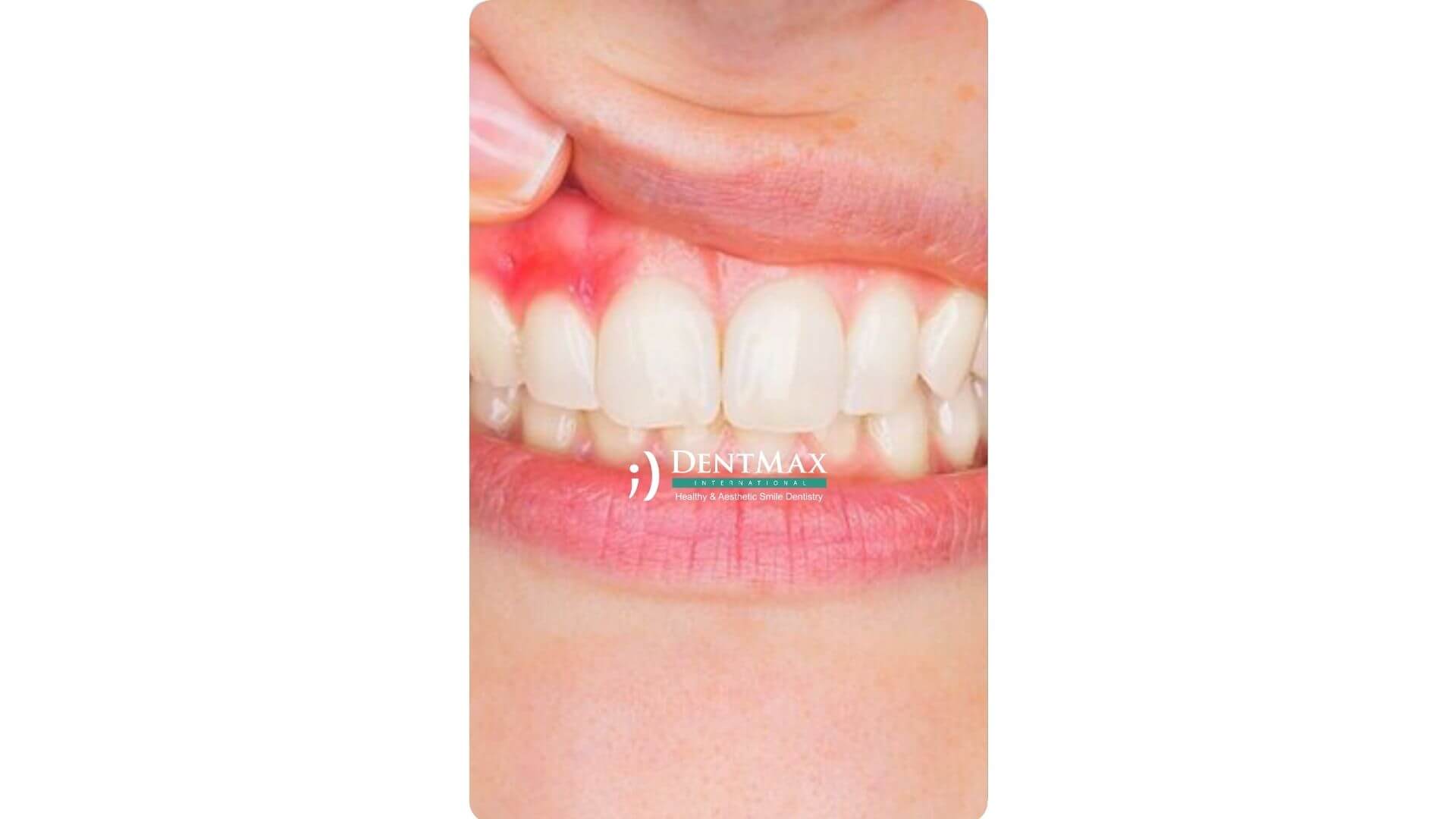 Dentmax Banner