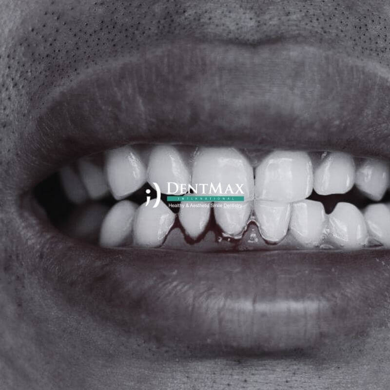 Dentmax Banner
