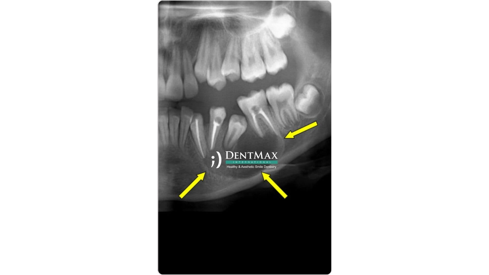 Dentmax Banner