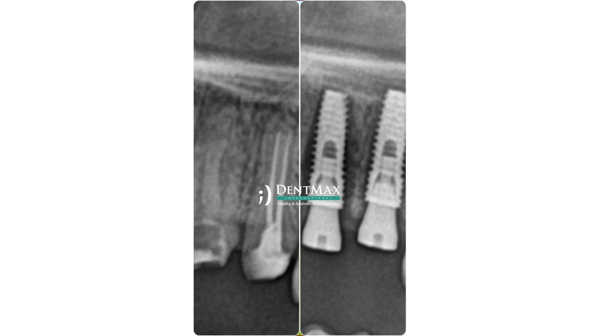 Dentmax Banner