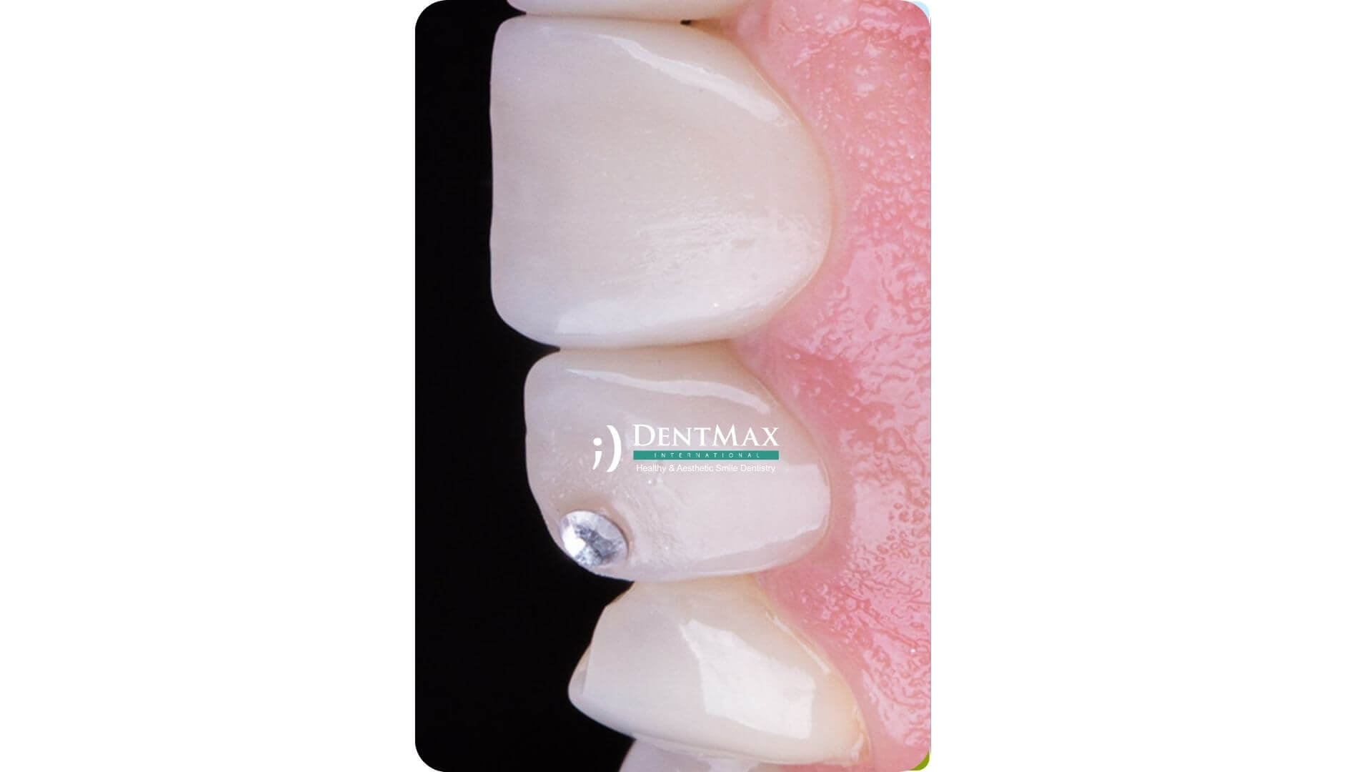 Dentmax Banner