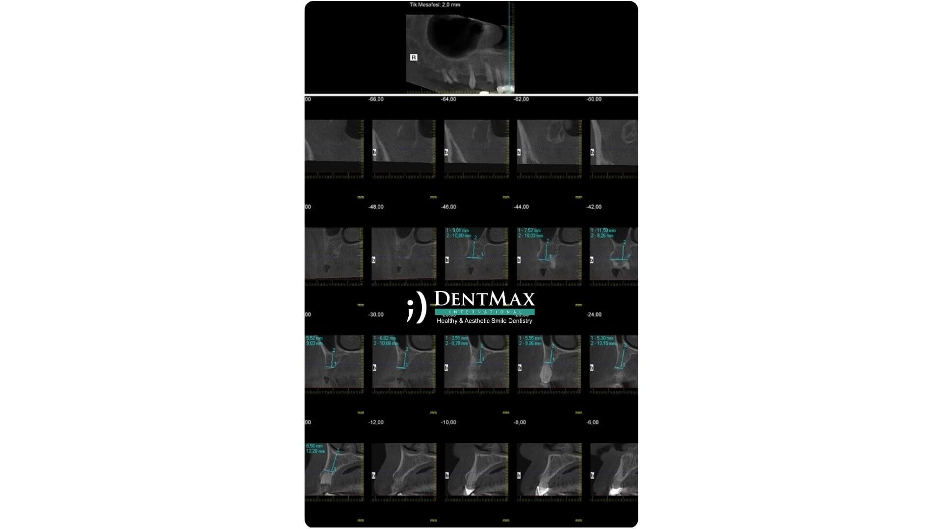 Dentmax Banner