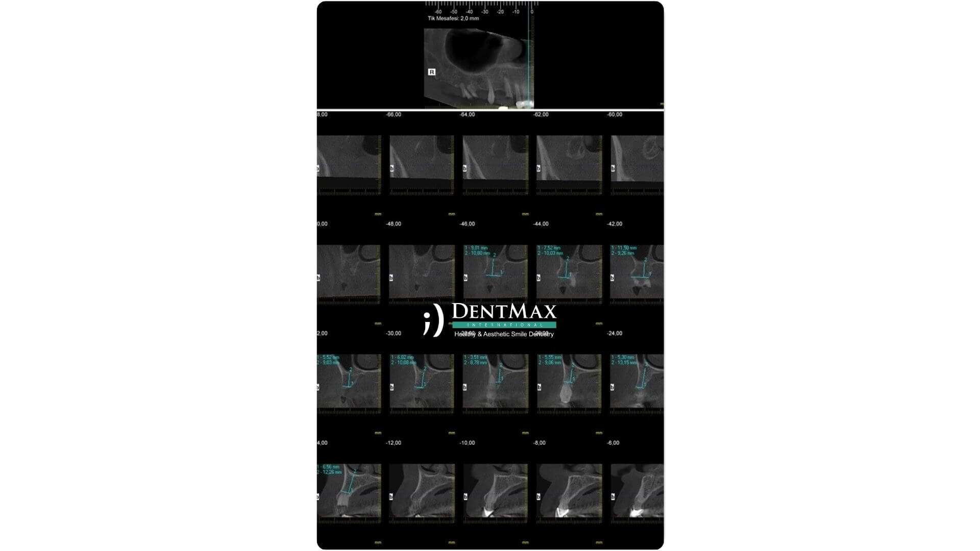Dentmax Banner