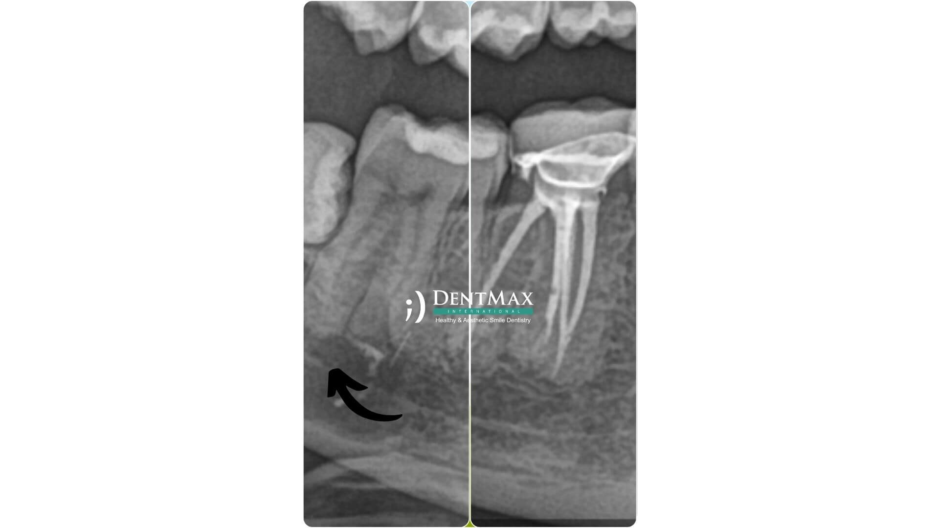 Dentmax Banner