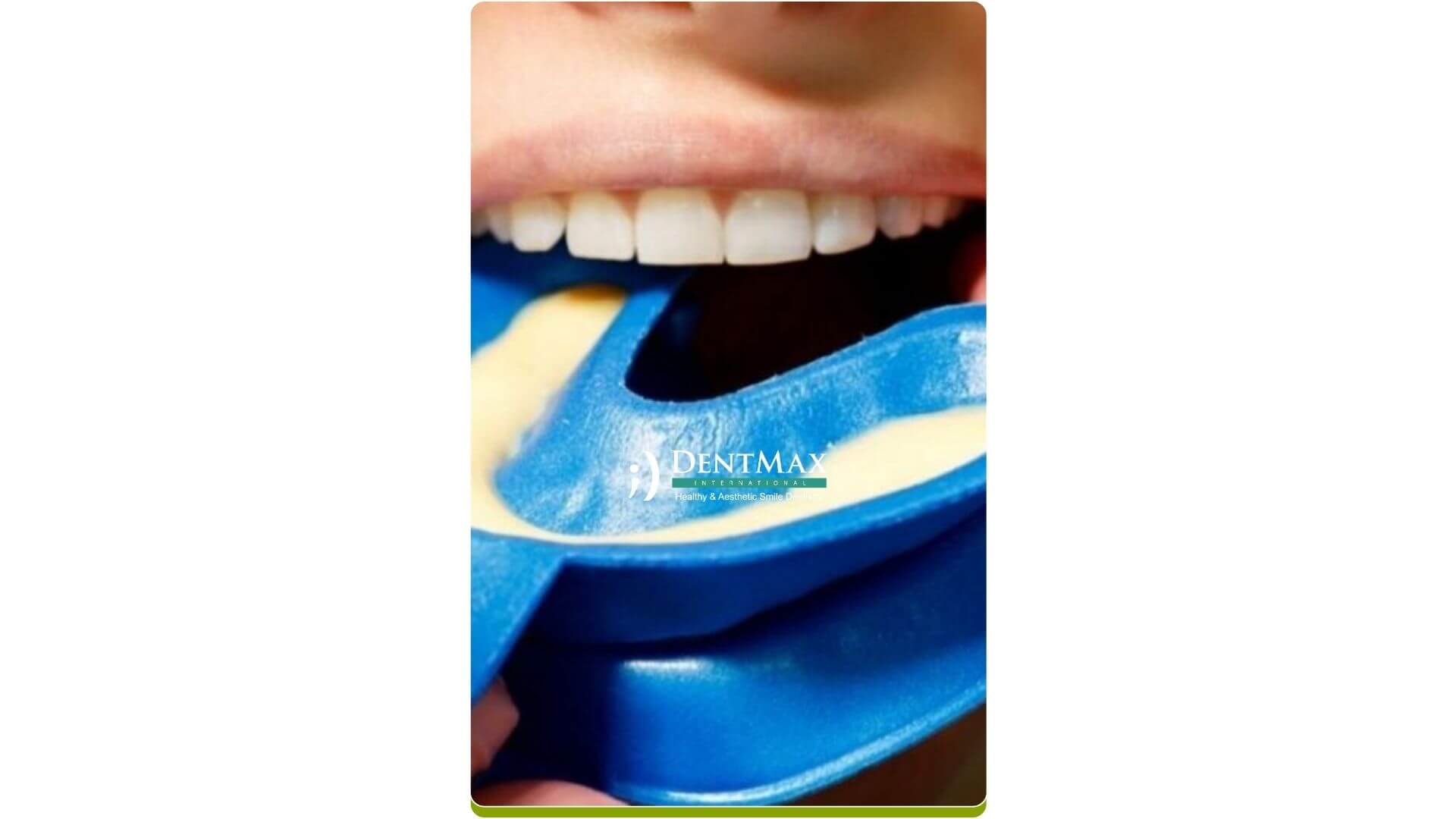 Dentmax Banner