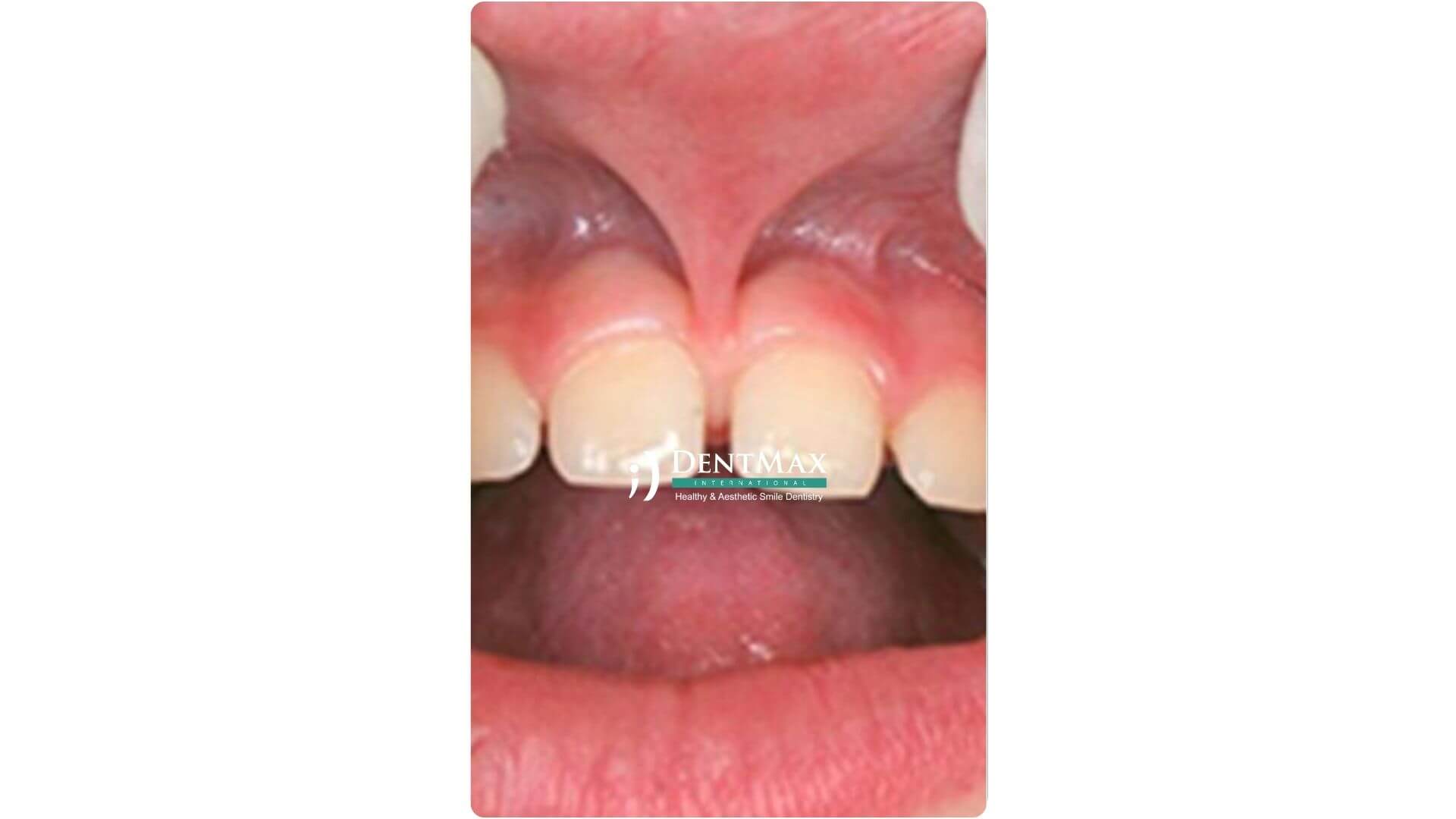 Dentmax Banner